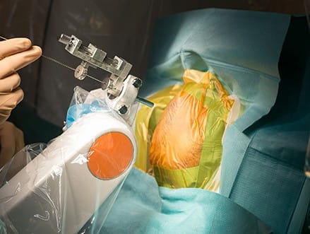 Επιληψία & Λειτουργική Νευροχειρουργική