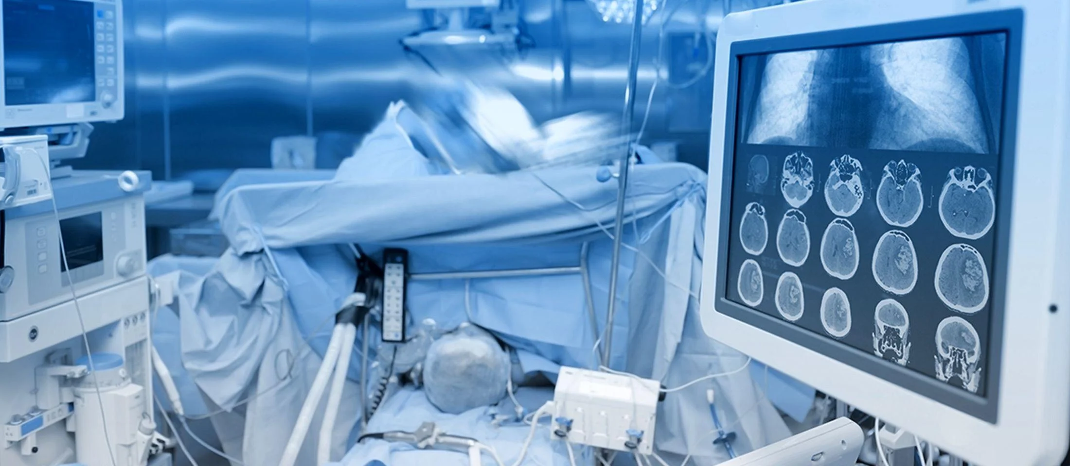 Υβριδικό χειρουργείο ΥΓΕΙΑ με νευροπλοήγηση και O-arm