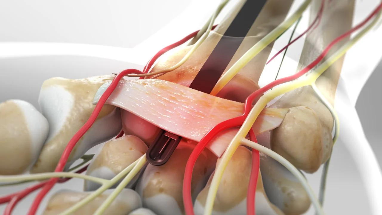 Περιφερικά Νεύρα